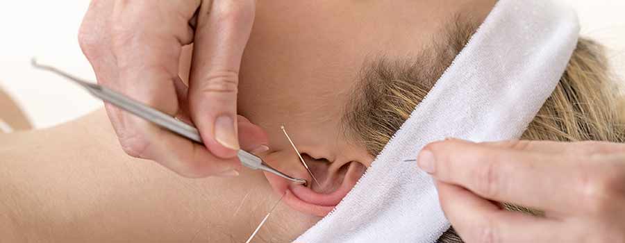 L’acupuncture de l’oreille dans la pratique  
